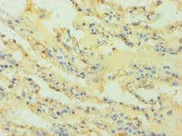 HLA-G Antibody (aa20-230)