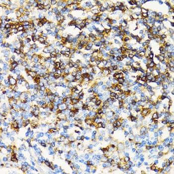 HLA-DRB3 Antibody