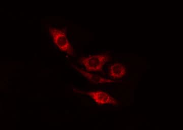 RICK / RIP2 Antibody