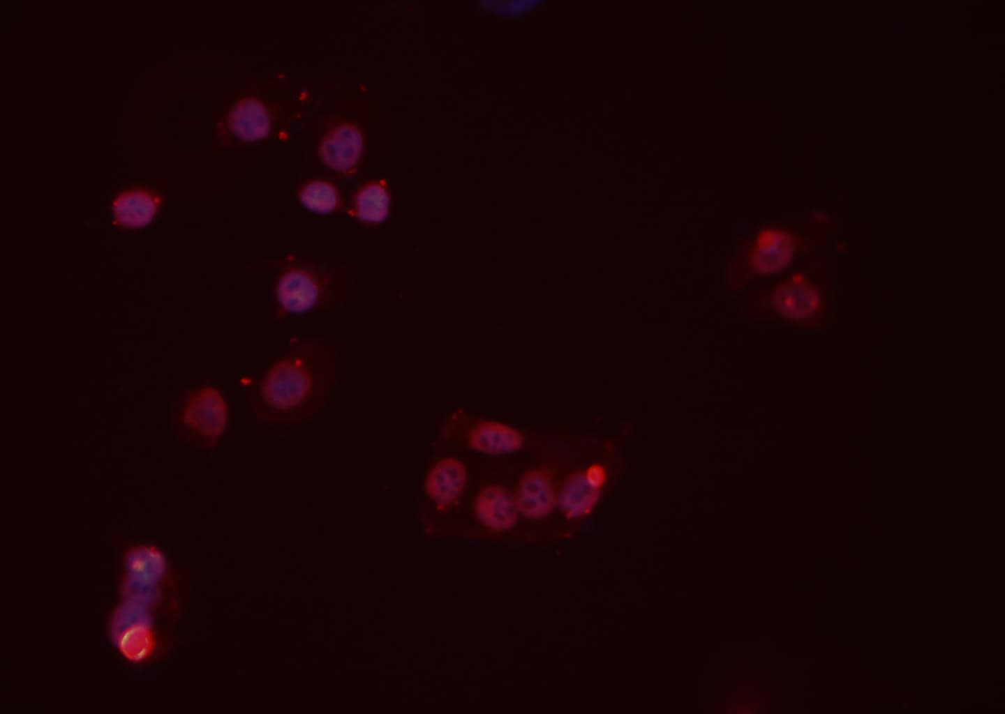 PP2CB / PPP2CB Antibody