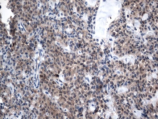 Monoclonal Mouse anti-Human CSTB / Cystatin B / Stefin B Antibody (clone OTI1E8, aa1-98, IHC, WB)