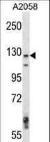 MAP3K6 / MEKK6 Antibody (aa223-252)
