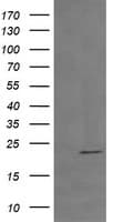 TCL / RHOJ Antibody (clone OTI1C8)