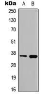 Polyclonal Rabbit anti-Human HNRNPA2B1 Antibody (N-Terminus, IHC, IF, WB)