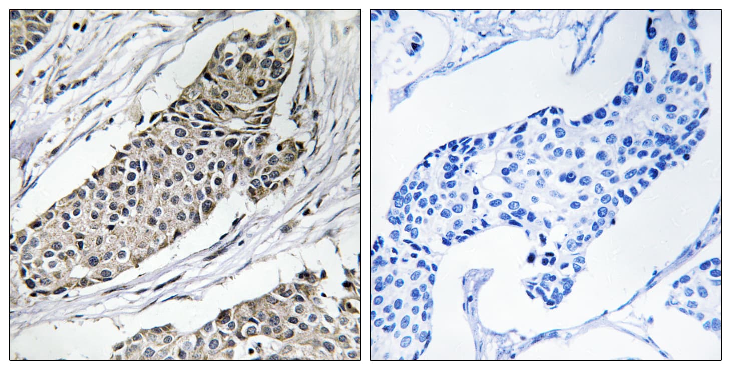 Polyclonal Rabbit anti-Human KCNAB3 Antibody (aa293-342, IHC)