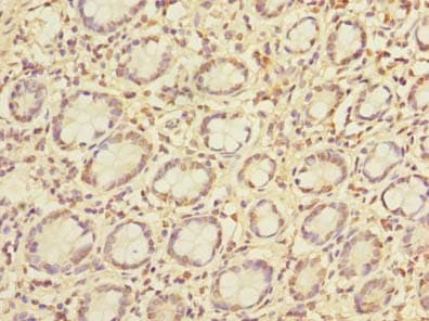 Polyclonal Rabbit anti-Human PCIF1 Antibody (IHC)
