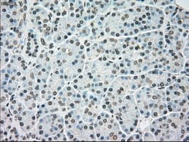 Monoclonal Mouse anti-Human BRAF / B-Raf Antibody (clone OTI1G6, IHC, WB)