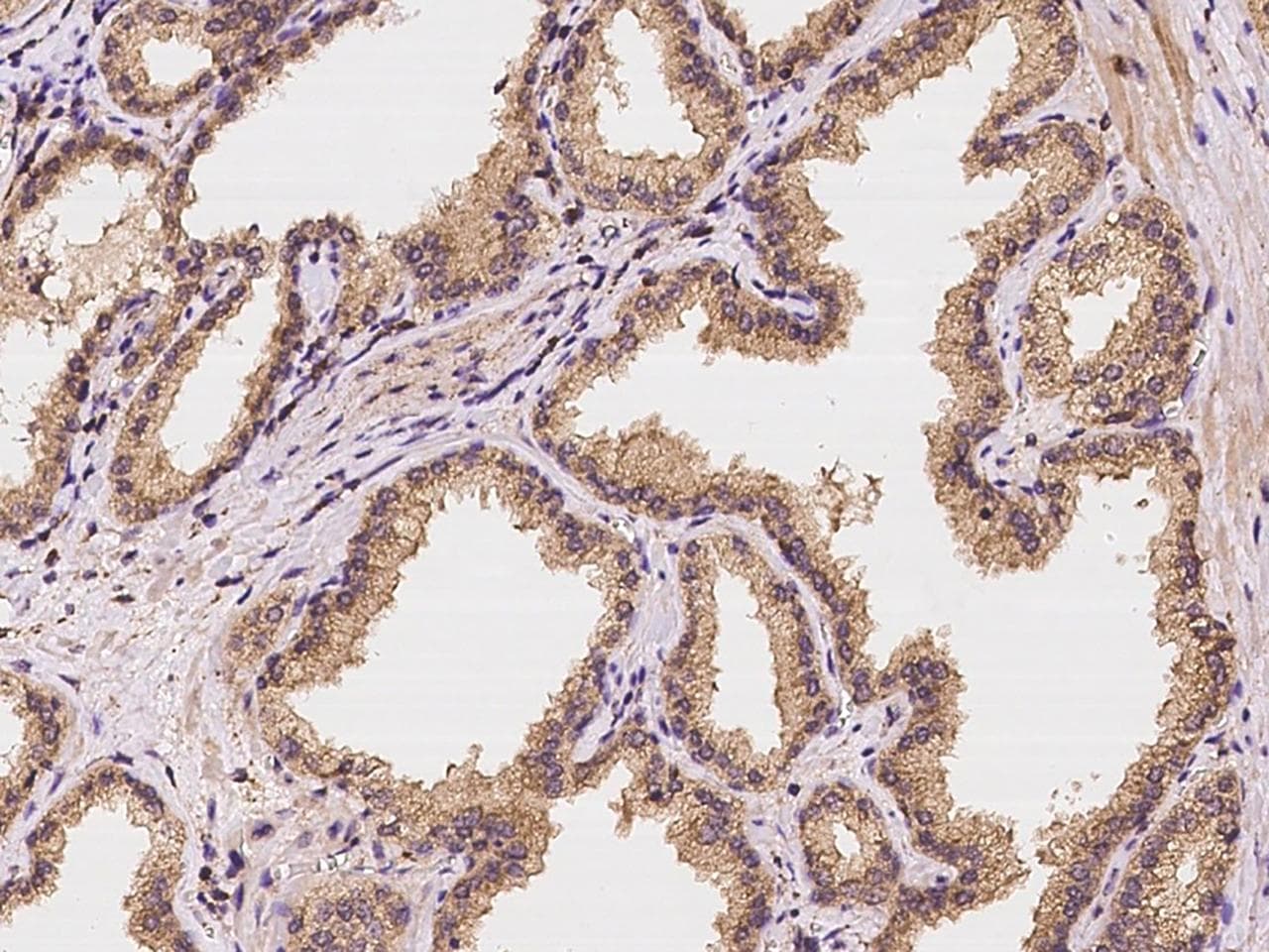 STAMBP / AMSH Antibody