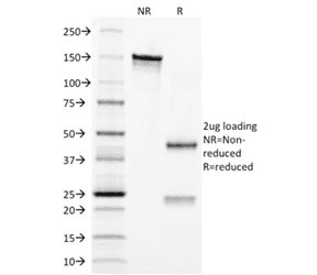 Monoclonal Mouse anti-Human CD3E Antibody (clone C3e/2479, Azide-free,BSA-free, IHC)