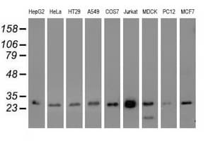 OTUB2 Antibody (clone OTI11B3)
