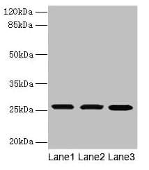 TMEM65 Antibody