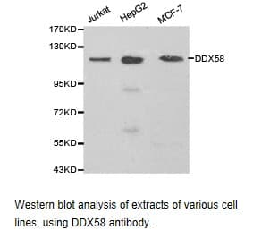 DDX58 / RIG-1 / RIG-I Antibody