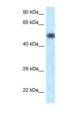 PIK3R1 / p85 Alpha Antibody (aa180-229)