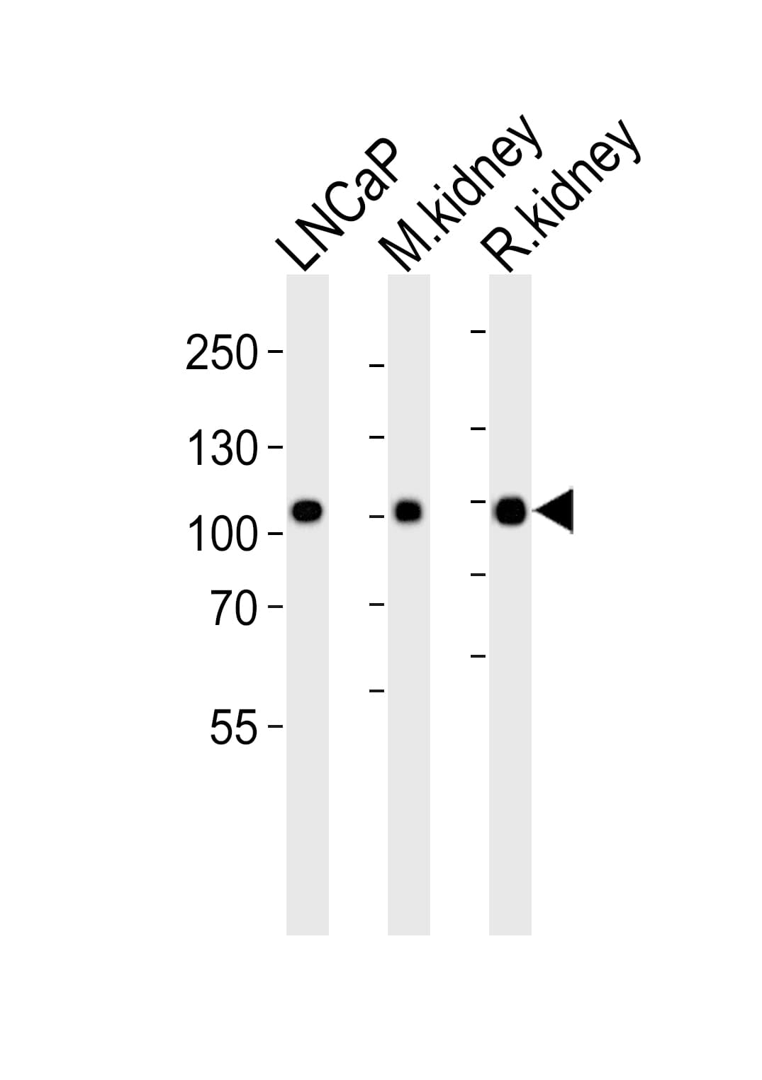 Polyclonal Rabbit anti-Human MME / CD10 Antibody (aa492-525, WB)