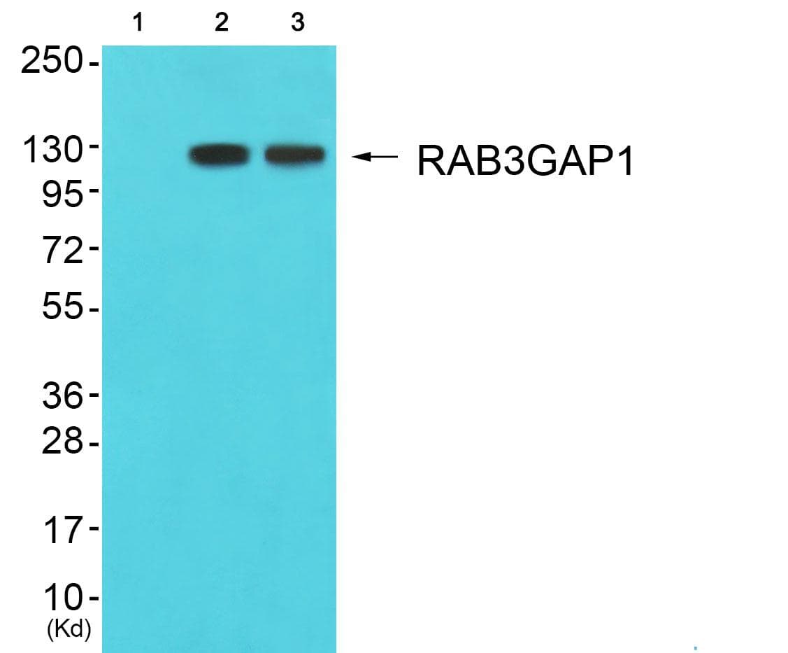 RAB3GAP1 Antibody