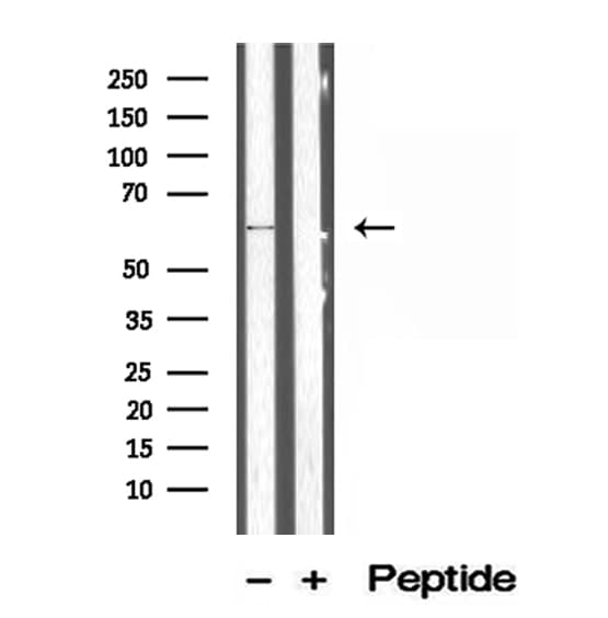 Polyclonal Rabbit anti-Human P4HA1 Antibody (IHC, IF, WB)