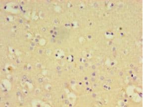 PTPN5 / STEP Antibody (aa300-555)