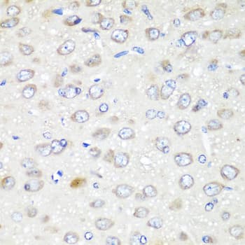 GABARAPL2 / ATG8 Antibody (AP)