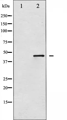 MAP2K4 / MKK4 Antibody