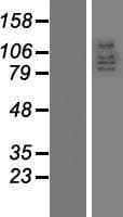 DLG5 Protein (Over-Expression Lysate Myc-DDK (Flag))