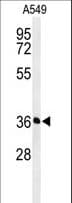 PAAF1 Antibody (aa109-138)