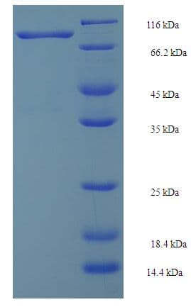 Human SMURF2 Protein (Recombinant GST)