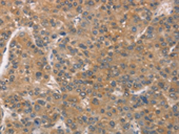 Polyclonal Rabbit anti-Human ZADH2 Antibody (IHC)