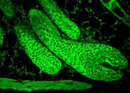 Polyclonal Rabbit anti-Human HSPA8 / HSC70 Antibody (aa650-670, IHC, IF, WB)