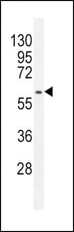MDM2 Antibody (aa393-424)