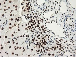 NMNAT1 / NMNAT Antibody (clone OTI1G4)