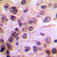 IKBKG / NEMO / IKK Gamma Antibody (phospho-Ser85)