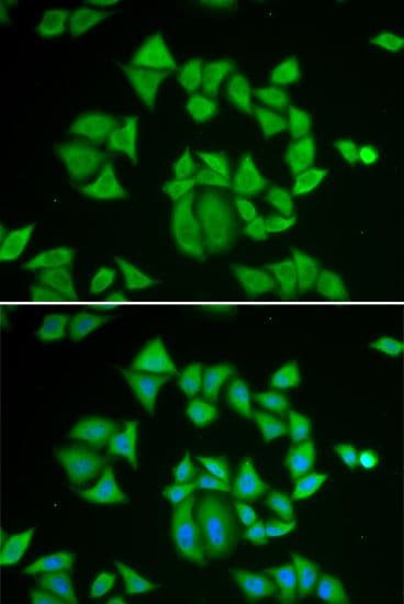GSTM2 Antibody