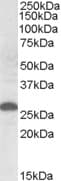 IHC-plus™ APOM / Apolipoprotein M Antibody (aa108-120)