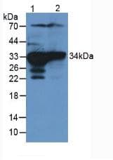 SULT1A1 / Sulfotransferase 1A1 Antibody (aa3-291, Cy3)