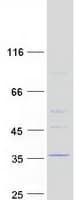Human TMEM53 Protein (Recombinant Myc-DDK (Flag))
