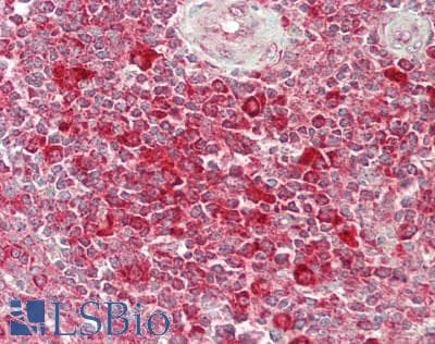 IHC-plus™ RPL26 / Ribosomal Protein L26 Antibody (aa100-C-term)