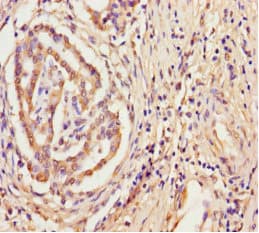 Polyclonal Rabbit anti-Human TPST2 Antibody (WB)