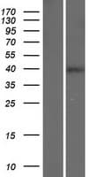 CD84 / SLAMF5 Protein (Over-Expression Lysate Myc-DDK (Flag))