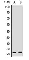 SFTPC / Surfactant Protein C Antibody