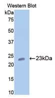COMP / THBS5 Antibody (aa235-423, PE)