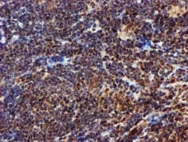 Monoclonal Mouse anti-Human EPM2AIP1 Antibody (clone OTI2A2, IHC, WB)