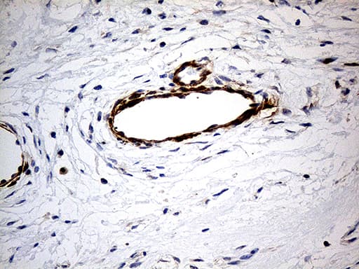 Monoclonal Mouse anti-Human KIF6 Antibody (clone OTI5G2, aa1-350, IHC, WB)