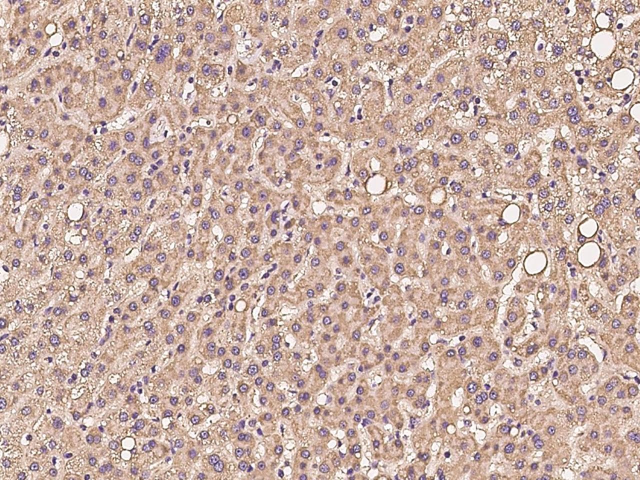 PKD2L2 Antibody