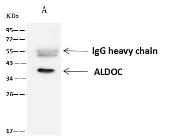 ALDOC / Aldolase C Antibody