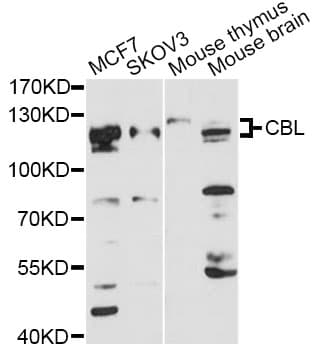 c-CBL Antibody