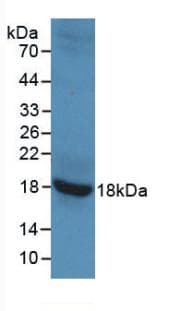 GAD65 Antibody (aa1-150)