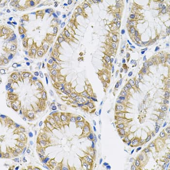 IL13 Antibody