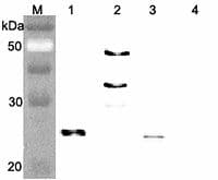 Polyclonal Rabbit anti-Human FGF21 Antibody (IHC, WB)