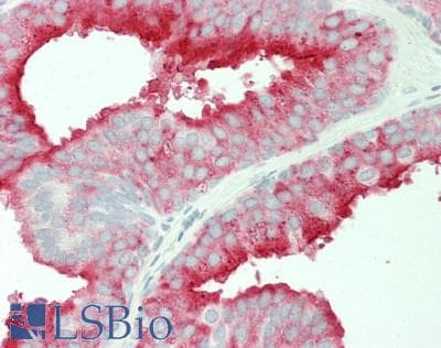 PathPlus™ FOLH1 / PSMA Antibody (clone 5A9)