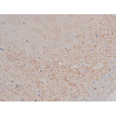 SNCA / Alpha-Synuclein Antibody (phospho-Ser129)